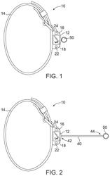 RETRACTION DEVICE HAVING A TENSIONING MECHANISM