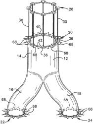 PERCUTANEOUS ENDOVASCULAR APPARATUS FOR REPAIR OF ANEURYSMS AND ARTERIAL BLOCKAGES