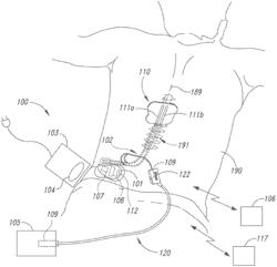 IMPLANTED PULSE GENERATORS WITH REDUCED POWER CONSUMPTION VIA SIGNAL STRENGTH/DURATION CHARACTERISTICS, AND ASSOCIATED SYSTEMS AND METHODS