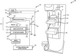 Breast compression and imaging systems and methods