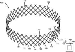 Expandable fire fence with additional safety features