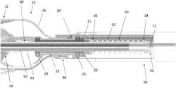 CATHETER BLOOD PUMP DISTAL BEARING ASSEMBLIES