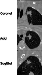 SYSTEM AND METHOD FOR MEDICAL IMAGING