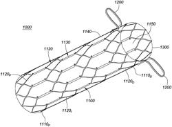 Transcatheter growth devices and methods for Norwood, Glenn and Fontan therapy