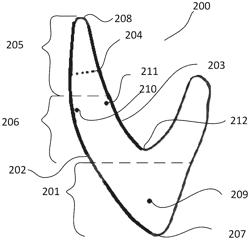 Method of masking a dental support structure of a dental prosthesis made of highly translucent ceramic material