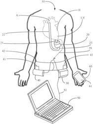 Implantable pump system having an undulating membrane