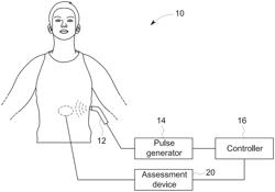 NEUROMODULATION ENERGY APPLICATION TECHNIQUES