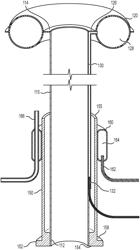 DEPLOYABLE FLEXIBLE OVERTUBE