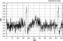 The Use of Local Amplifiers and a Huygens Sensor Array in Measuring Bioelectrical Signals and Clinical Applications Thereof