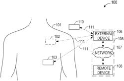 ENTROPY BASED HEART SOUND TRACKING