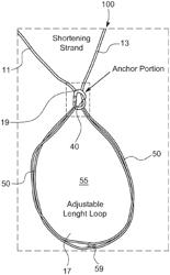 Knotless All-Inside Suture Constructs and Methods of Tissue Fixation