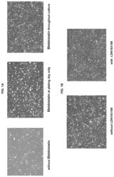 CULTURE MEDIUM, COATING MATRIX AND METHOD FOR EXPANDING MIDBRAIN DOPAMINERGIC PROGENITOR CELLS