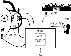 GAMING HEADSET WITH ACTIVE NOISE CANCELLATION