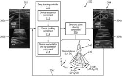 Automatic closed-loop ultrasound plane steering for target localization in ultrasound imaging and associated devices, systems, and methods