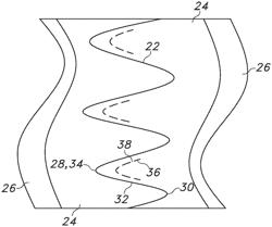 Stent-graft with improved flexibility