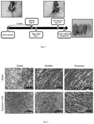 Pharmaceutical composition for prevention or treatment of preterm birth