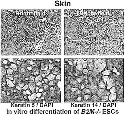 BETA-2 MICROGLOBULIN-DEFICIENT CELLS