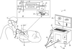 STABILIZING INTRA-OCULAR PRESSURE AT ONSET OF ASPIRATION