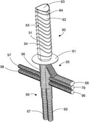 Hybrid prosthesis and delivery system