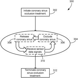 SYSTEMS, PROGRAMS AND METHODS FOR DETERMINING WHEN TO TERMINATE A CORONARY SINUS OCCLUSION TREATMENT