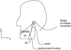 Virtual Dental Articulator