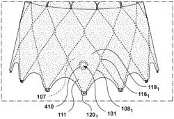 TRANSCATHETER HEART VALVE PROSTHESIS SYSTEMS AND METHODS FOR ROTATIONAL ALIGNMENT