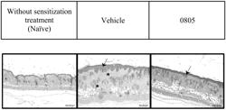 METHOD FOR TREATING DERMATITIS AND PHARMACEUTICAL COMPOSITION FOR TREATING DERMATITIS CONTAINING AN ADENOSTEMMA LAVENIA EXTRACT