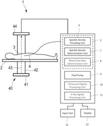 Blood flow determination apparatus