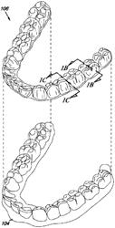 Dental materials using thermoset polymers