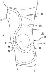 Orthopedic device and method for securing the same