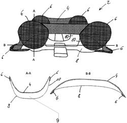 Technical orthopaedic device for supporting an extremity of a patient