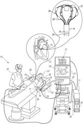 POSITION TRACKING FOR PULSED FIELD ABLATION