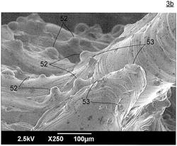 SURFACE TREATMENT METHOD FOR SURGICAL IMPLANT AND SURGICAL IMPLANT