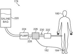 Electrocardiogram noise reduction