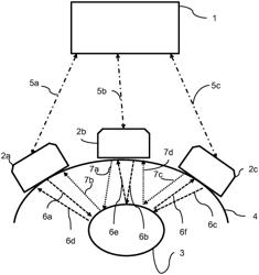 Ultrasound imaging apparatus and method