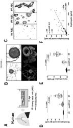 Modulators of airway basal cells for the treatment or prevention of lung diseases