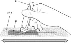 WOUND CLOSURE DEVICE