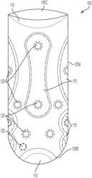 Prosthetic liner with selective pressure adjustment