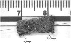 HEMORRHAGE MANAGEMENT SYSTEM