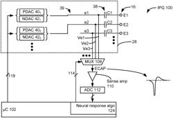 Circuitry to Assist with Neural Sensing in an Implantable Stimulator Device