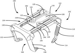 Sternal closure device with dual locking mechanism