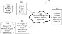 SYSTEMS, DEVICES, AND METHODS FOR NON-INVASIVE IMAGE-BASED PLAQUE ANALYSIS AND RISK DETERMINATION