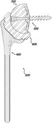 Shoulder arthroplasty systems and configurations for components thereof