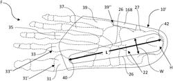 AUXILIARY OR INTEGRATED INNER SOLE STRUCTURE FOR FOOTWEAR