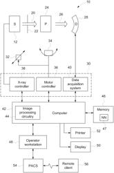 SYSTEM AND METHOD FOR DEEP-LEARNING BASED ESTIMATION OF CORONARY ARTERY PRESSURE DROP