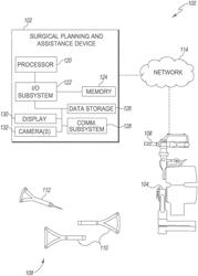 SYSTEMS AND METHODS FOR BONE MODEL REGISTRATION WITH ADAPTIVE SOFT TISSUE THICKNESS