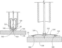 Methods and apparatus for deploying sheet-like materials