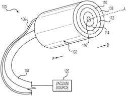 Medical systems, devices, and related methods