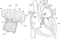 Prosthetic valves and related inventions