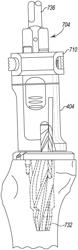 System for preparing a patient's tibia in an orthopaedic joint replacement procedure